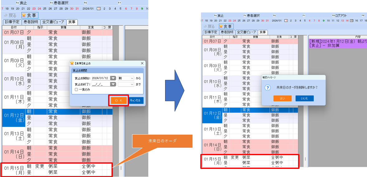 0101xml_003_ShokujiAllowNoCancelAfterStop_001.png